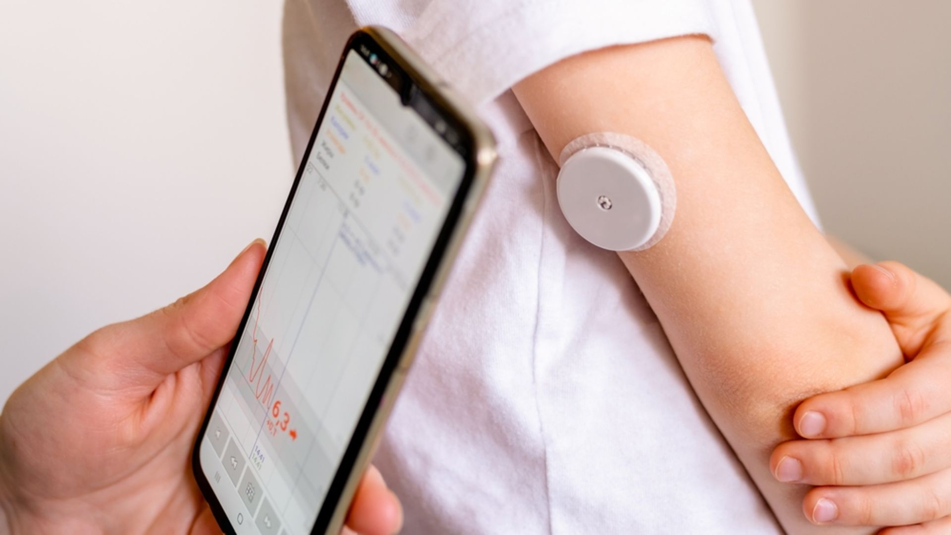 Sensörlü cilt altı glukoz izlem cihazlarını SGK karşılıyor mu?